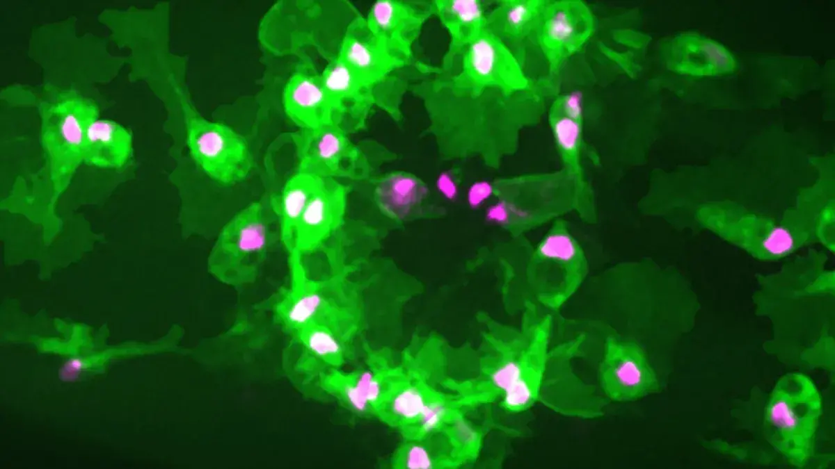 Live confocal imaging reveals immune cells (green) with their nuclei  labelled (magenta) clustered at a wound made to a Drosophila embryo.