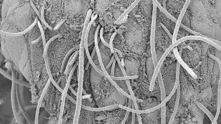 Microscopy image showing fine, thread-like structures (bacteria) interacting with bowel wall