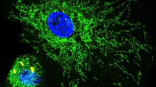 Microscopy images showing macrophages with mitochondria, DNA, and S. pneumoniae bacteria 