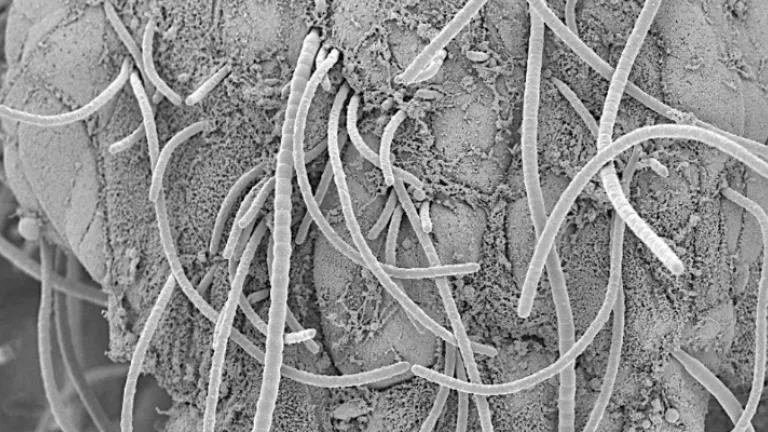 Microscopy image showing fine, thread-like structures (bacteria) interacting with bowel wall