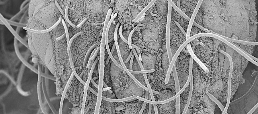 Microscopy image showing fine, thread-like structures (bacteria) interacting with bowel wall