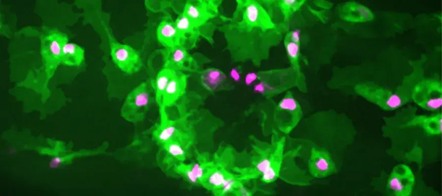 Microscope image of immune cells (green) with their nuclei labelled (magenta) clustered at a wound made to a Drosophila embryo