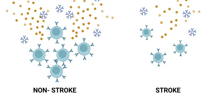 Comparison of immune cells from patients after stroke vs no stroke