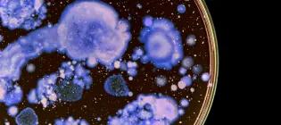 Petri dish with growing bacteria (purple) on agar