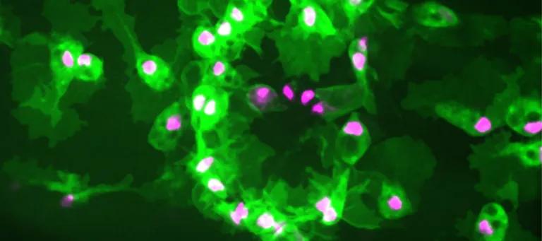 Microscope image of immune cells (green) with their nuclei labelled (magenta) clustered at a wound made to a Drosophila embryo