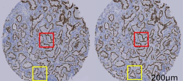 Two circular tissue samples (lilac), with blue squiggly patterns staining the samples