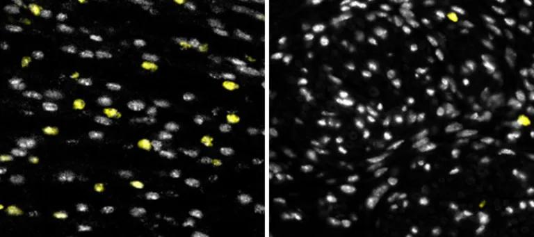 White dots which are cells on a black background on right hand side with few yellow dots, and similar on the left hand side but with more yellow dots