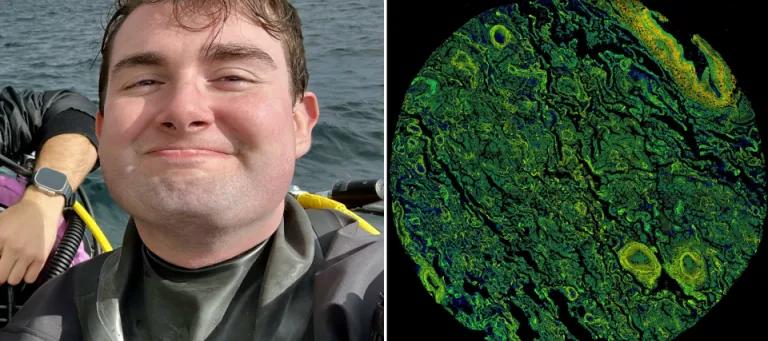 Headshot of Alex on the left and green microscopy image on the right