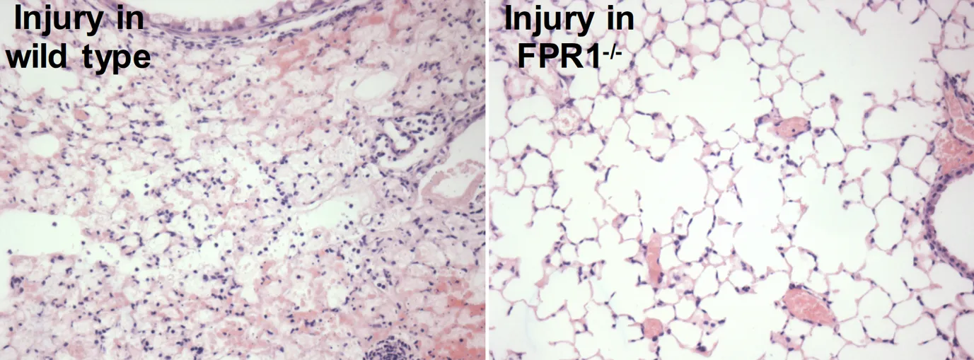 Reduced inflammation in FPR1-/- mice compared with wild type after lung injury