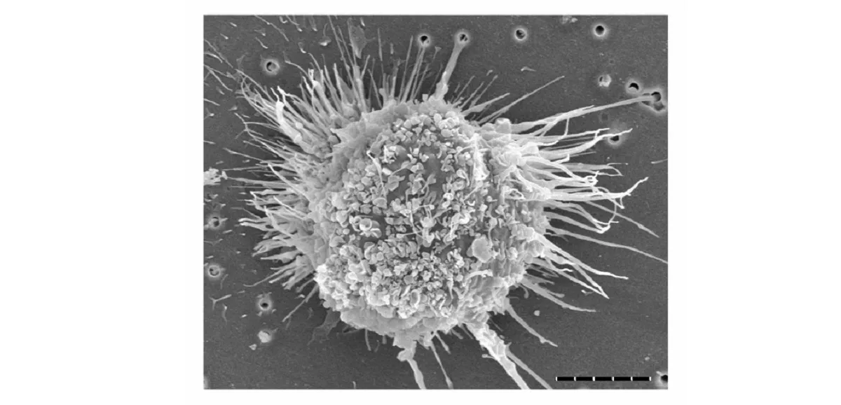 Image of dendritic cell spreadout