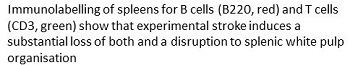 Description of B and T cells