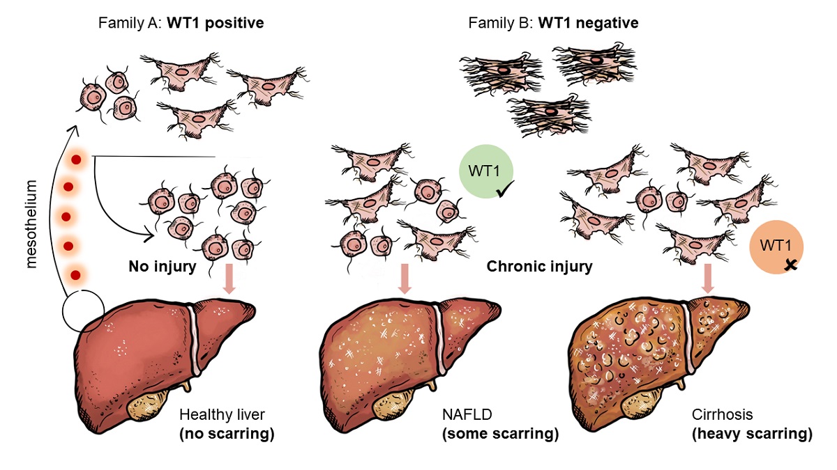 Image of liver injury