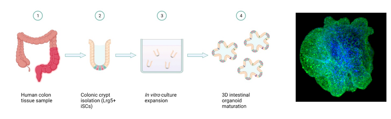 Image of mini-guts